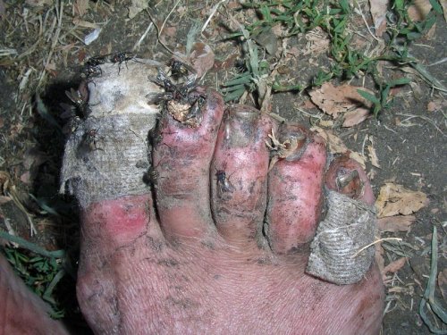 A thru-hiker's foot at mile marker 1650 on the Pacific Crest Trail. Don't let your feet turn out like this, y'all! (Photo courtesty of pbase.com)